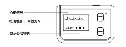 verite 动态心电图记录器-深圳市博声医疗器械有限公司