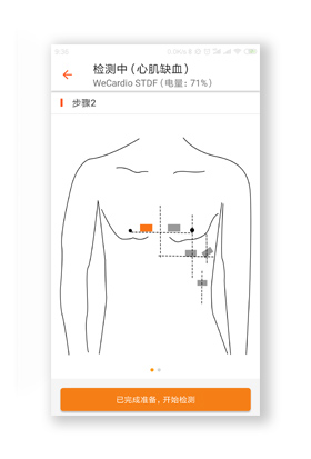 无线心电监测仪-Wecardio UN-深圳市博声医疗器械有限公司